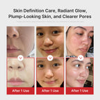 Appareil de soin du visage Age-R Booster Pro 6-en-1 avec massage facial technologie de soin de la peau rechargeable couleur rose